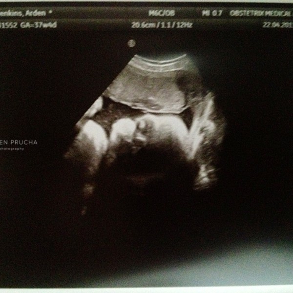 37 weeks 4 days